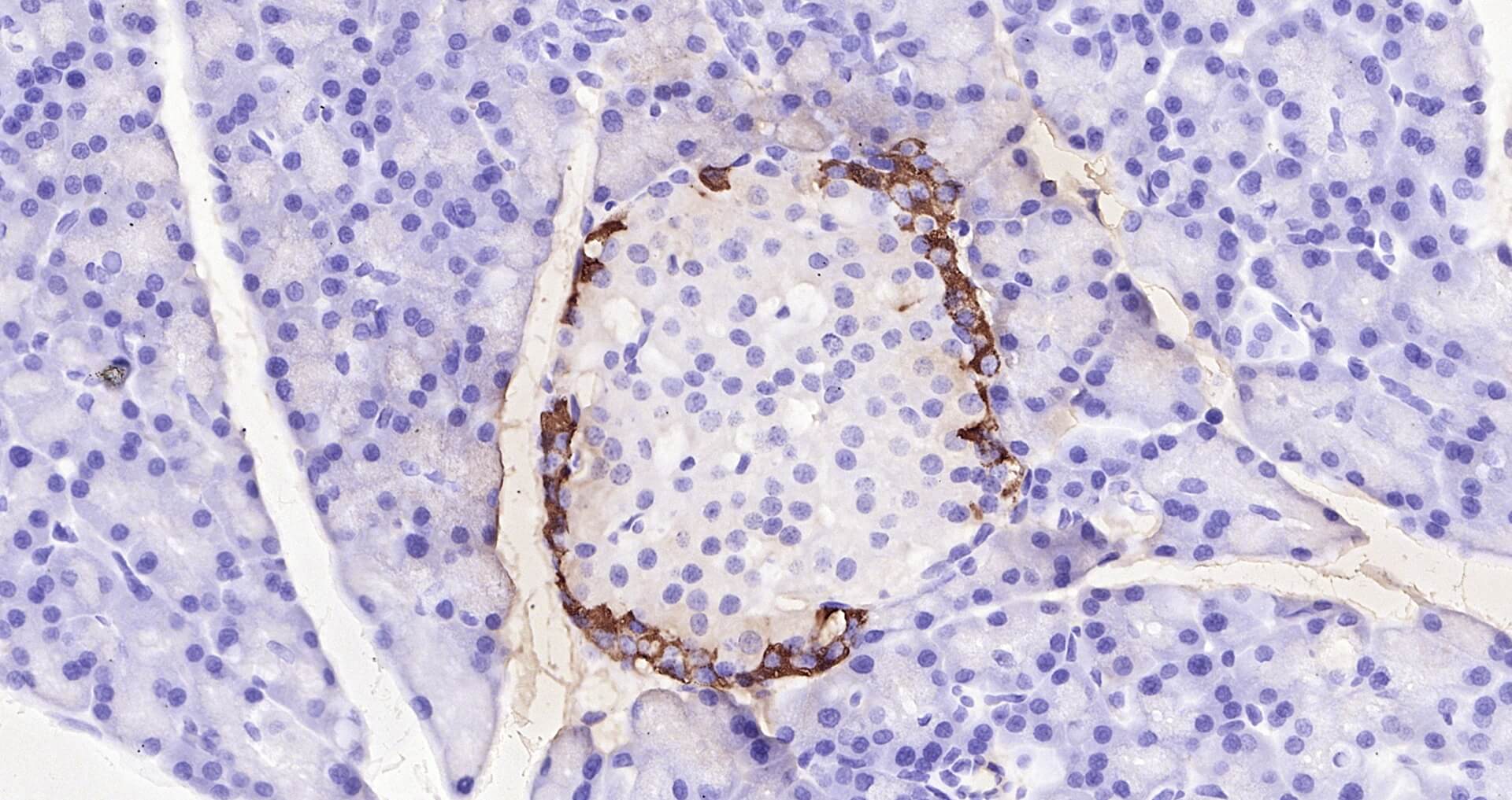 大鼠胰高血糖素即用型免疫组化试剂盒-IHC0104R